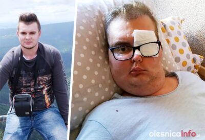 Brajan walczy z guzem mózgu. Pomóżmy w zbiórce pieniędzy na leczenie w Meksyku