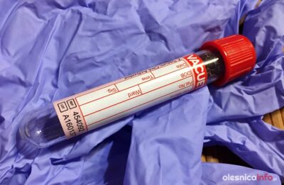 Jedenaście przypadków koronawirusa w powiecie oleśnickim