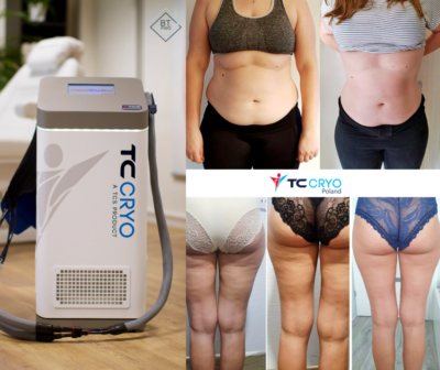 Mega przełom w redukcji tkanki tłuszczowej. Gabinet Zdrowy Kręgosłup zaprasza