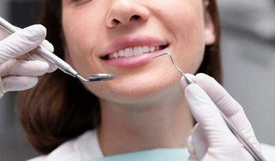 Piękny i zdrowy uśmiech dzięki bondingowi zębów