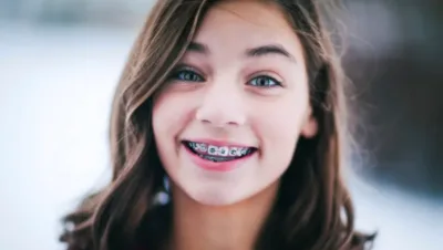 Aparat stały, ruchomy czy nakładkowy – Jak dobrać metodę leczenia ortodontycznego?