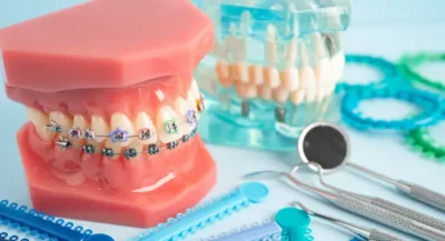 Jak przygotować się do leczenia ortodontycznego? Sprawdź z OrthoVision